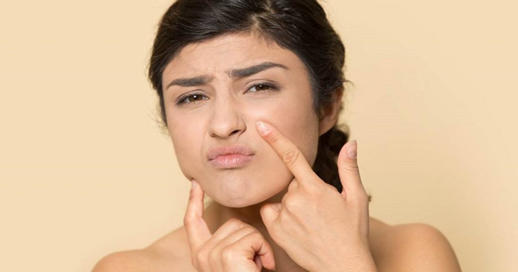 စDehydrated Skin မဖြစ်အောင် ဘယ်လိုကာကွယ်ကြမလဲ?